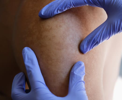 closeup-dermatologist-examining-patients-skin-pigmentation-medical-clinic-doctor-looks